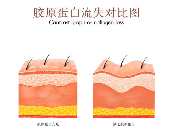 从内到外：胶原蛋白如何影响皮肤的整体状态？